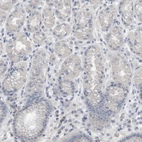 Immunohistochemical staining of human stomach shows low expression as expected.