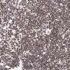 Anti-HNRNPM Antibody