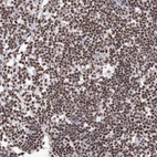 Anti-HNRNPM Antibody