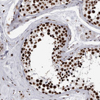 Immunohistochemical staining of human testis shows strong nuclear positivity in cells.