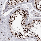 Immunohistochemical staining of human testis shows strong nuclear positivity in cells.
