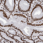 Immunohistochemical staining of human stomach shows strong nuclear positivity in glandular cells.