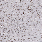 Anti-HNRNPM Antibody