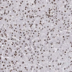Immunohistochemical staining of human liver shows moderate nuclear positivity in hepatocytes.