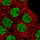 Immunofluorescent staining of human cell line A-431 shows localization to nucleoplasm.