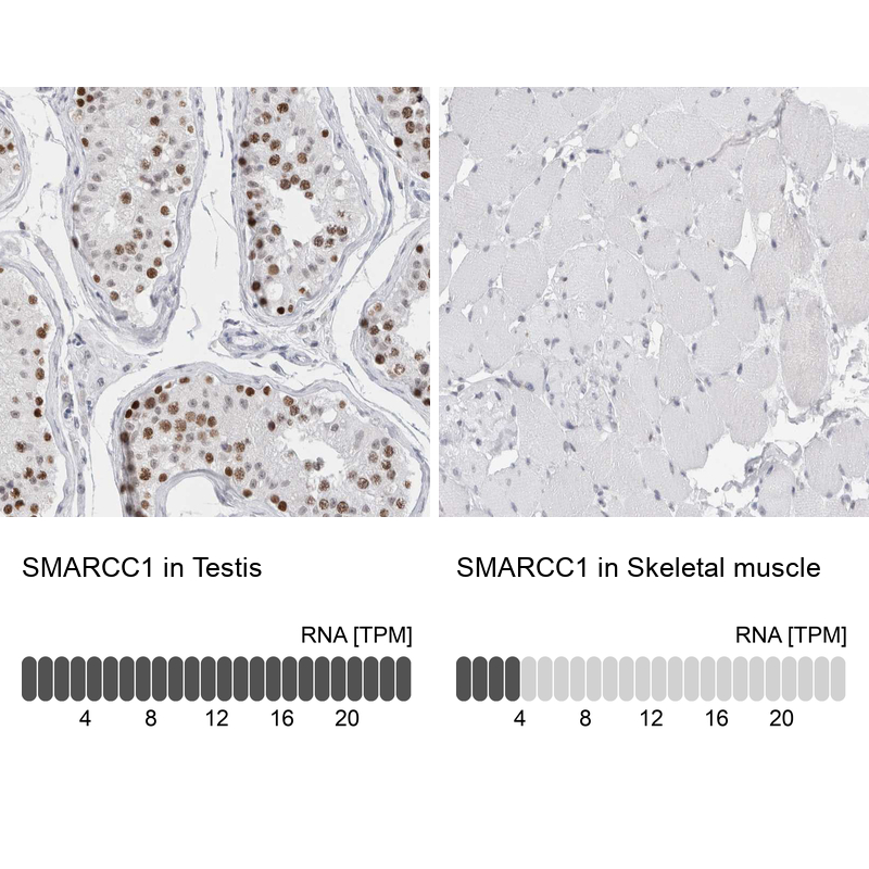 Anti-SMARCC1 Antibody
