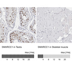 Anti-SMARCC1 Antibody