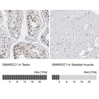 Anti-SMARCC1 Antibody