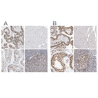 Immunohistochemical staining of human placenta, skeletal muscle, testis and tonsil using Anti-SMARCC1 antibody HPA024352 (A) shows similar protein distribution across tissues to independent antibody HPA026853 (B).