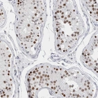 Immunohistochemical staining of human testis shows strong nuclear positivity in cells in seminiferous ducts.