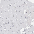 Immunohistochemical staining of human skeletal muscle shows no positivity in myocytes as expected.