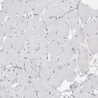 Immunohistochemical staining of human skeletal muscle shows no positivity in myocytes as expected.
