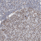Immunohistochemical staining of human tonsil shows moderate to strong nuclear positivity in germinal center cells.