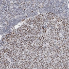 Immunohistochemical staining of human tonsil shows moderate to strong nuclear positivity in germinal center cells.