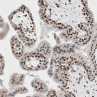 Immunohistochemical staining of human placenta shows strong nuclear positivity in trophoblastic cells.