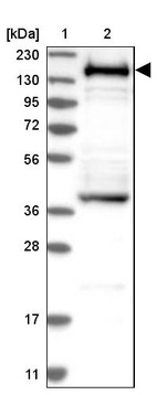 Lane 1: Marker [kDa] 230, 130, 95, 72, 56, 36, 28, 17, 11_br/_Lane 2: Human cell line RT-4