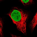 Immunofluorescent staining of human cell line U-2 OS shows localization to nucleoplasm.