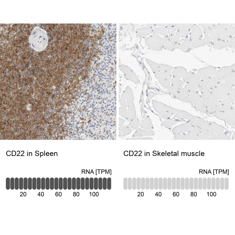 Anti-CD22 Antibody