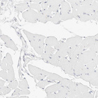 Immunohistochemical staining of human skeletal muscle shows no positivity in myocytes as expected.
