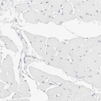 Immunohistochemical staining of human skeletal muscle shows no positivity in myocytes as expected.