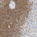 Immunohistochemical staining of human spleen shows strong cytoplasmic positivity in cells in white pulp.