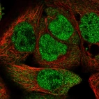 Immunofluorescent staining of human cell line A-431 shows localization to nucleoplasm & cytosol.
