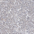 Immunohistochemical staining of human pancreas shows low expression as expected.