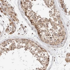 Immunohistochemical staining of human testis shows strong cytoplasmic positivity in cells in seminiferous ducts.