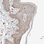 Immunohistochemical staining of human skin shows 
moderate cytoplasmic positivity in squamous epithelial cells.