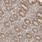 Immunohistochemical staining of human stomach shows strong cytoplasmic positivity in glandular cells.