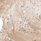 Immunohistochemical staining of human skeletal muscle shows moderate cytoplasmic positivity in myocytes.