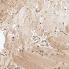 Immunohistochemical staining of human skeletal muscle shows moderate cytoplasmic positivity in myocytes.