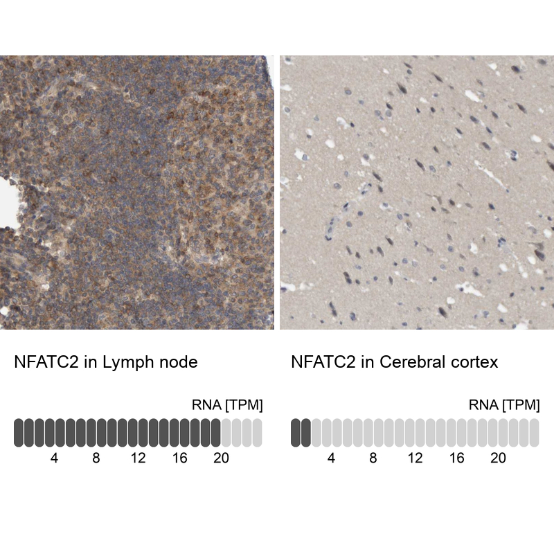Anti-NFATC2 Antibody