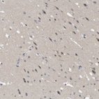 Immunohistochemical staining of human cerebral cortex shows low expression as expected.