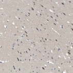 Immunohistochemical staining of human cerebral cortex shows low expression as expected.