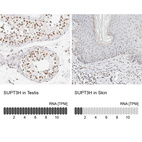 Anti-SUPT3H Antibody