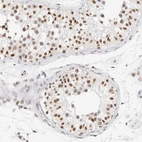 Immunohistochemical staining of human testis shows high expression.