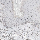 Immunohistochemical staining of human skin shows low expression as expected.