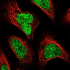 Immunofluorescent staining of human cell line U-2 OS shows localization to nucleoplasm.