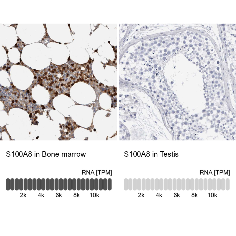Anti-S100A8 Antibody