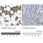 Anti-S100A8 Antibody