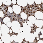 Immunohistochemical staining of human bone marrow shows high expression.
