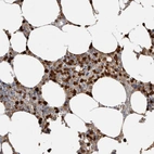 Immunohistochemical staining of human bone marrow shows moderate cytoplasmic positivity in hematopoietic cells in addition to nucleus positivity.