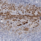 Immunohistochemical staining of human tonsil shows strong cytoplasmic positivity in squamous epithelial cells in addition to nucleus positivity.