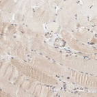 Immunohistochemical staining of human skeletal muscle shows very weak positivity in myocytes as expected.