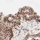 Immunohistochemical staining of human placenta shows strong nuclear positivity in trophoblastic cells.