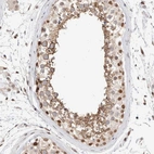 Immunohistochemical staining of human testis shows moderate nuclear positivity in cells in seminiferous ducts.