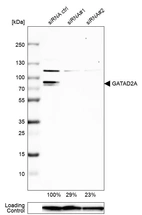 Western blot analysis in U-138MG cells transfected with control siRNA, target specific siRNA probe #1 and #2, using Anti-GATAD2A antibody. Remaining relative intensity is presented. Loading control: Anti-GAPDH.