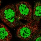 Immunofluorescent staining of human cell line A-431 shows localization to nucleoplasm.