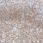 Immunohistochemical staining of human tonsil shows high expression.